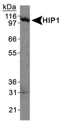 Western Blot: HIP1 Antibody (1B11) [NB300-204]