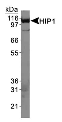 Western Blot: HIP1 Antibody (4B10) [NB300-203]