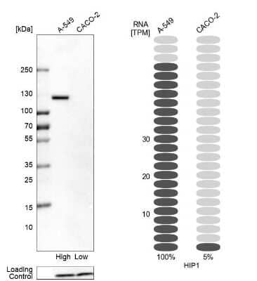 Western Blot: HIP1 Antibody [NBP1-81592]