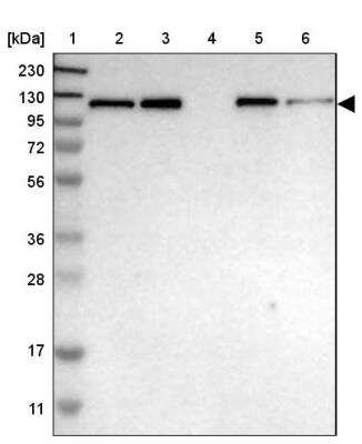 Western Blot: HIP1 Antibody [NBP1-81593]