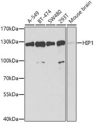 Western Blot: HIP1 AntibodyBSA Free [NBP3-05022]