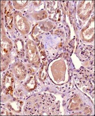 Immunohistochemistry-Paraffin: HIP1 Related Antibody (1E1) [NB300-206]