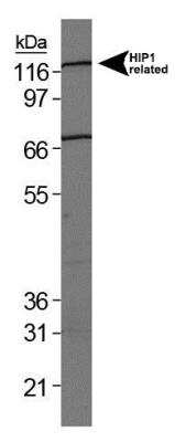 Western Blot: HIP1 Related Antibody (1E1) [NB300-206]