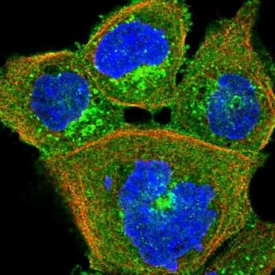 Immunocytochemistry/ Immunofluorescence: HIP1 Related Antibody [NBP2-38390]