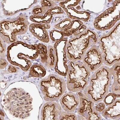 Immunohistochemistry: HIP1 Related Antibody [NBP2-38390]