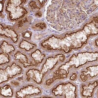 Immunohistochemistry: HIP1 Related Antibody [NBP2-38391]