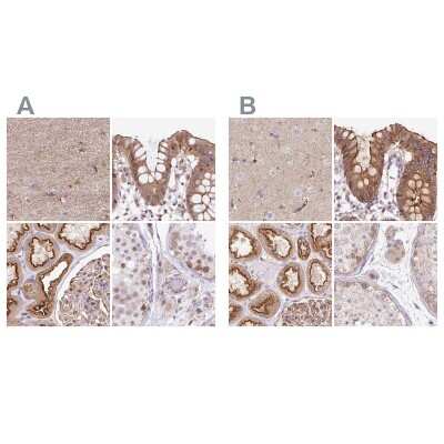 Immunohistochemistry-Paraffin: HIP1 Related Antibody [NBP2-38390]