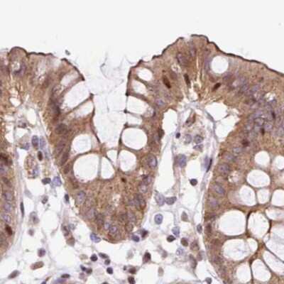 Immunohistochemistry-Paraffin: HIP1 Related Antibody [NBP2-38390]