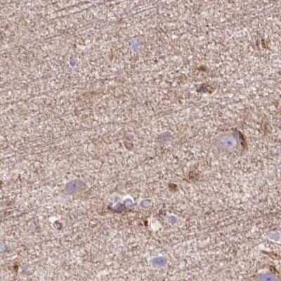 Immunohistochemistry-Paraffin: HIP1 Related Antibody [NBP2-38390]