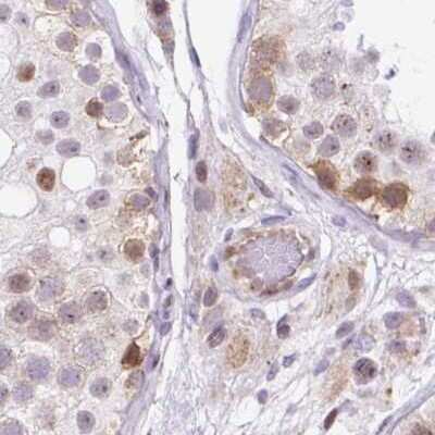 Immunohistochemistry-Paraffin: HIP1 Related Antibody [NBP2-38390]