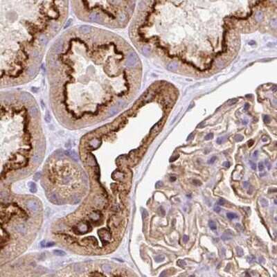 Immunohistochemistry-Paraffin: HIP1 Related Antibody [NBP2-38390]