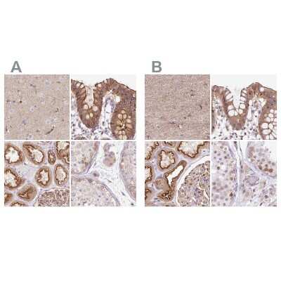 Immunohistochemistry-Paraffin: HIP1 Related Antibody [NBP2-38391]