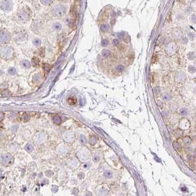 Immunohistochemistry-Paraffin: HIP1 Related Antibody [NBP2-38391]