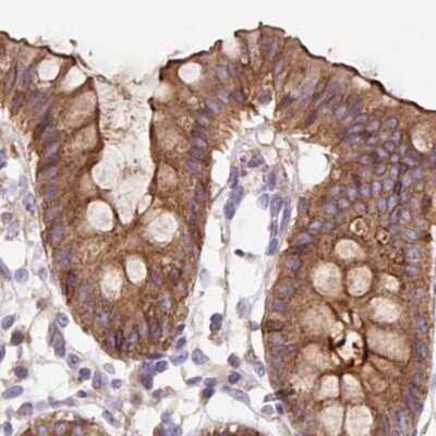 Immunohistochemistry-Paraffin: HIP1 Related Antibody [NBP2-38391]