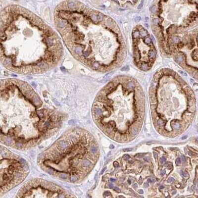Immunohistochemistry-Paraffin: HIP1 Related Antibody [NBP2-38391]