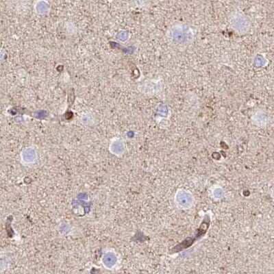 Immunohistochemistry-Paraffin: HIP1 Related Antibody [NBP2-38391]