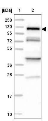 Western Blot: HIP1 Related Antibody [NBP2-38390]