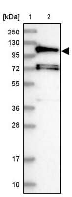 Western Blot: HIP1 Related Antibody [NBP2-38391]