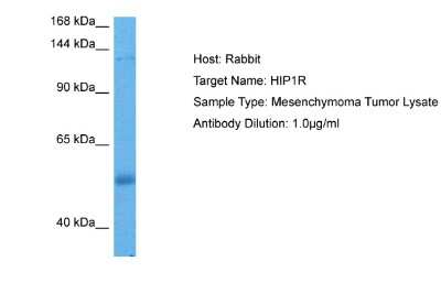 Western Blot: HIP1 Related Antibody [NBP2-87567]