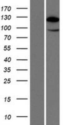 Western Blot: HIP1 Related Overexpression Lysate [NBP2-10554]