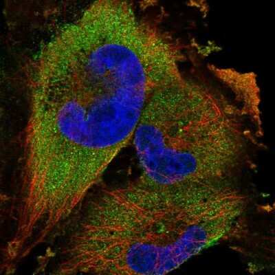 Immunocytochemistry/ Immunofluorescence: UBE2K/E2-25K Antibody [NBP1-91987]