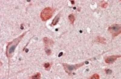 Immunohistochemistry-Paraffin: UBE2K/E2-25K Antibody [NB300-840]