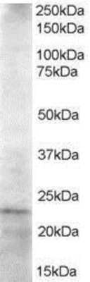 Western Blot: UBE2K/E2-25K Antibody [NB300-840]