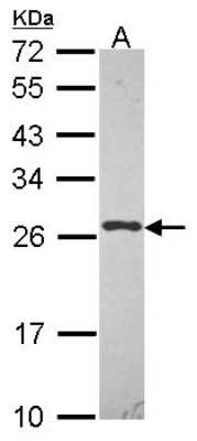 Western Blot: UBE2K/E2-25K Antibody [NBP2-16831]