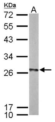 Western Blot: UBE2K/E2-25K Antibody [NBP2-16831]