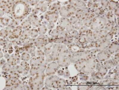 Immunohistochemistry-Paraffin: HIPK1 Antibody (1D6) [H00204851-M06]