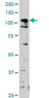 Western Blot: HIPK1 Antibody (1F2) [H00204851-M04]