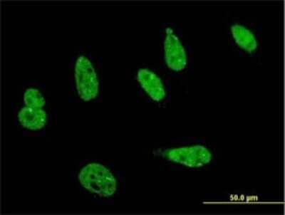 Immunocytochemistry/ Immunofluorescence: HIPK1 Antibody (4C2) [H00204851-M01]