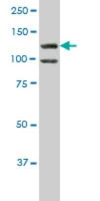 Western Blot: HIPK1 Antibody (4E1) [H00204851-M07]