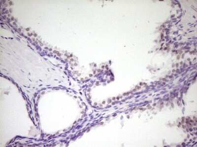 Immunohistochemistry: HIPK1 Antibody (OTI5F1) [NBP2-45973]