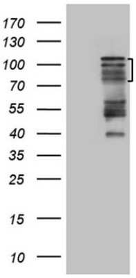 Western Blot: HIPK1 Antibody (OTI5F1) [NBP2-45973]