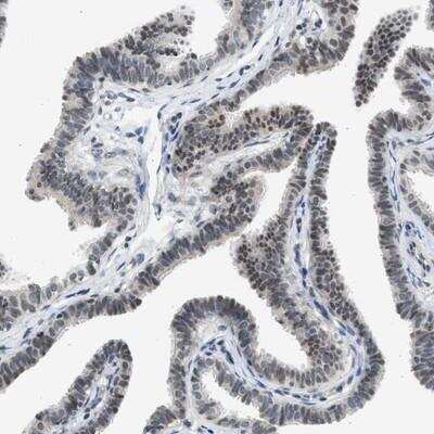 Immunohistochemistry-Paraffin: HIPK1 Antibody [NBP1-82981]