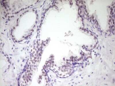 Immunohistochemistry: HIPK1 Antibody (OTI5F1) - Azide and BSA Free [NBP2-72460]