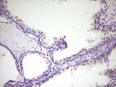 Immunohistochemistry: HIPK1 Antibody (OTI5F1) - Azide and BSA Free [NBP2-72460]