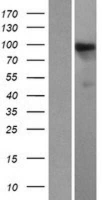 Western Blot: HIPK1 Overexpression Lysate [NBP2-10081]