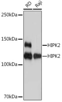 Western Blot: HIPK2 Antibody (3Z5P6) [NBP3-16825]