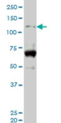 Western Blot: HIPK2 Antibody (4E3) [H00028996-M06]