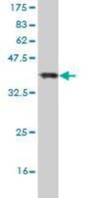 Western Blot: HIPK2 Antibody (4F4) [H00028996-M01]
