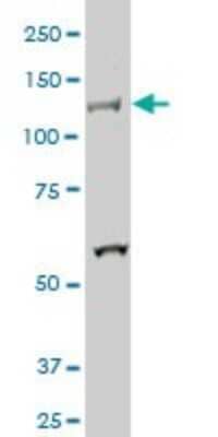 Western Blot: HIPK2 Antibody (4F4) [H00028996-M01]