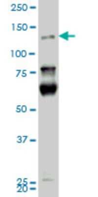 Western Blot: HIPK2 Antibody (4F4) [H00028996-M01]
