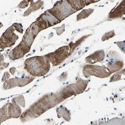 Immunohistochemistry-Paraffin: HIPK2 Antibody [NBP1-89462]