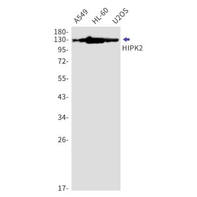 Western Blot: HIPK2 Antibody (S06-5G2) [NBP3-19873]