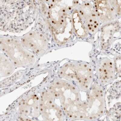Immunohistochemistry-Paraffin: HIPK3 Antibody [NBP1-84950]