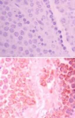 Immunohistochemistry-Paraffin: HIPK3 Antibody - BSA Free [NBP2-24521]