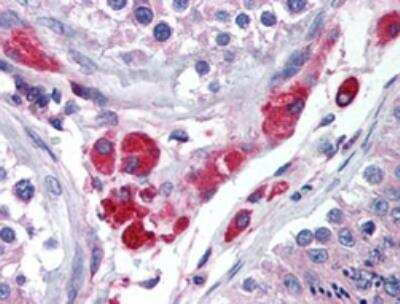 Immunohistochemistry-Paraffin: HIPK3 Antibody - BSA Free [NBP2-24521]