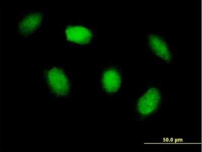Immunocytochemistry/ Immunofluorescence: HIPK4 Antibody [H00147746-B01P]